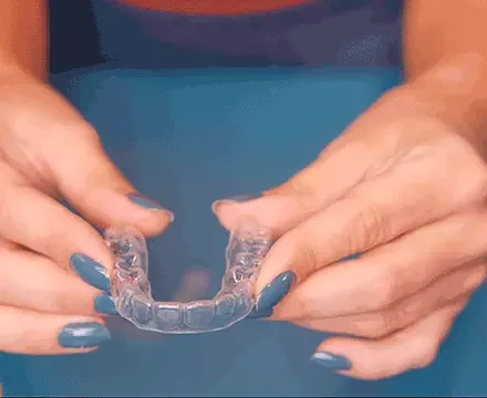 Alinhador invisível SouSmile transparente para tratamento ortodôntico em Sorocaba